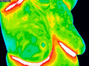 Sample-ACCT-Thermography